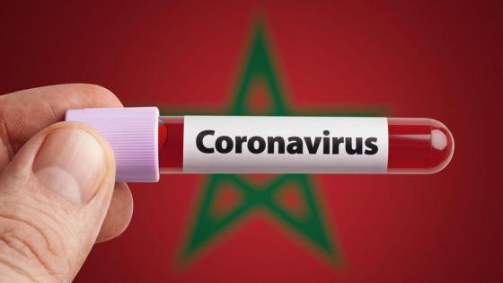 وزارة الصحة تسجل 71 حالة مؤكدة بفيروس كورونا خلال 24 ساعة