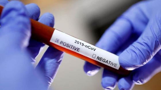 وزارة الصحة تسجل 36 حالات مؤكدة بفيروس كورونا على الساعة 10 صباحا