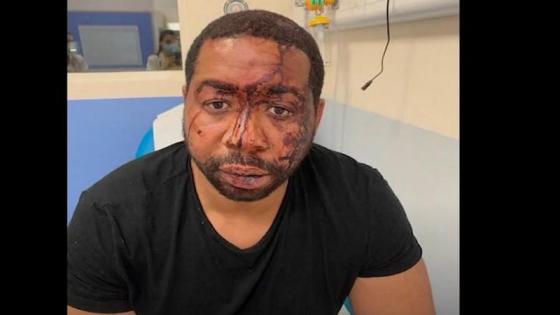 غضب كبير في فرنسا بعد اعتداء الشرطة على موسيقي ذو أصول إفريقية
